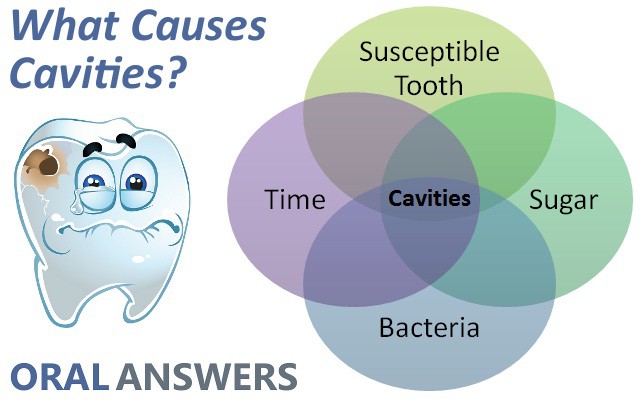 caries causes